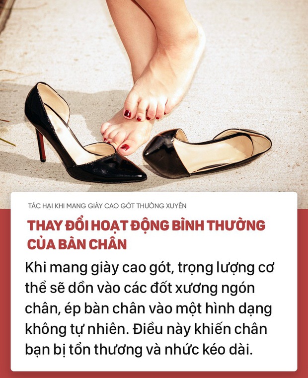 5 Tips bảo vệ đôi chân cho chị em nhân sự nghề khách sạn hay mang giày cao gót