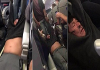 Vụ bác sĩ gốc Việt bị kéo lê khỏi máy bay United Airlines khiến dư luận phẫn nộ