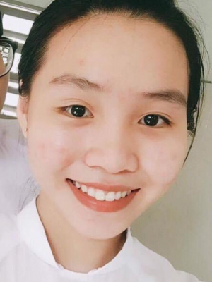Lâm Ngọc Bảo Kim